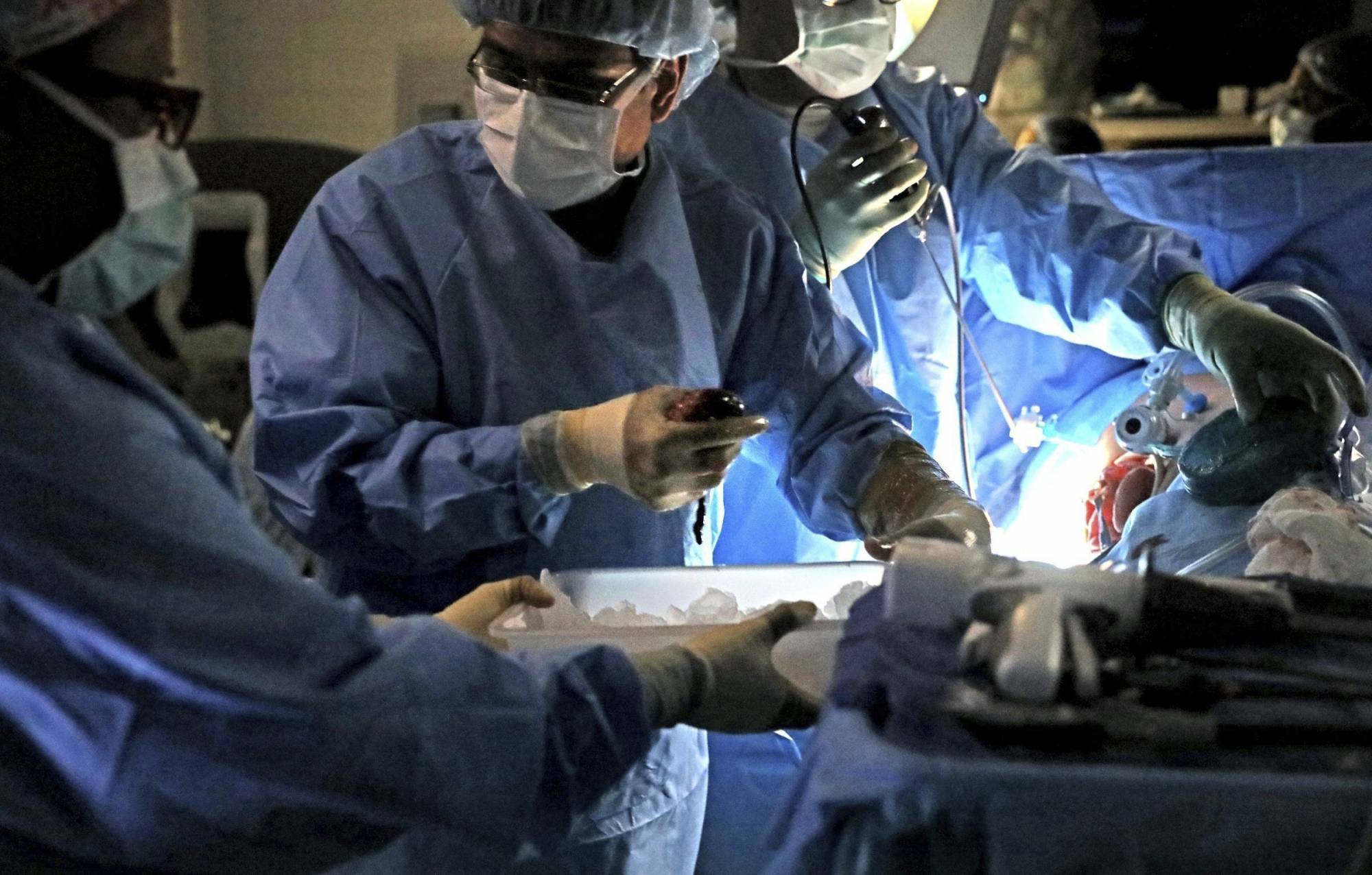 FILE- In this Jan. 17, 2018, file photo, SLUCare transplant surgeon Dr. Chintalapati Varma physically grabs the kidney from the body of living organ donor Robyn Rosenberger during surgery at SSM Health Saint Louis University Hospital in St. Louis. British researchers reported Monday, Jan. 29, that living kidney donors are more likely to develop later kidney failure than non-donors, and female donors may experience a pregnancy complication, problematic high blood pressure (Laurie Skrivan/St. Louis Post-Dispatch via AP, File)