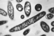 This 1978 electron microscope image made available by the Centers for Disease Control and Prevention shows Legionella pneumophila bacteria which are responsible for causing the pneumonic disease Legionnaires' disease. In a report released Wednesday, Aug. 14, 2019, the National Academies of Sciences, Engineering and Medicine said annual cases of Legionnaires’ jumped more than fivefold from 2000 to 2017, and that as many as 70,000 Americans get the disease every year. High-profile recent outbreaks occurred in Atlanta and Flint, Michigan. (Francis Chandler/CDC via AP)