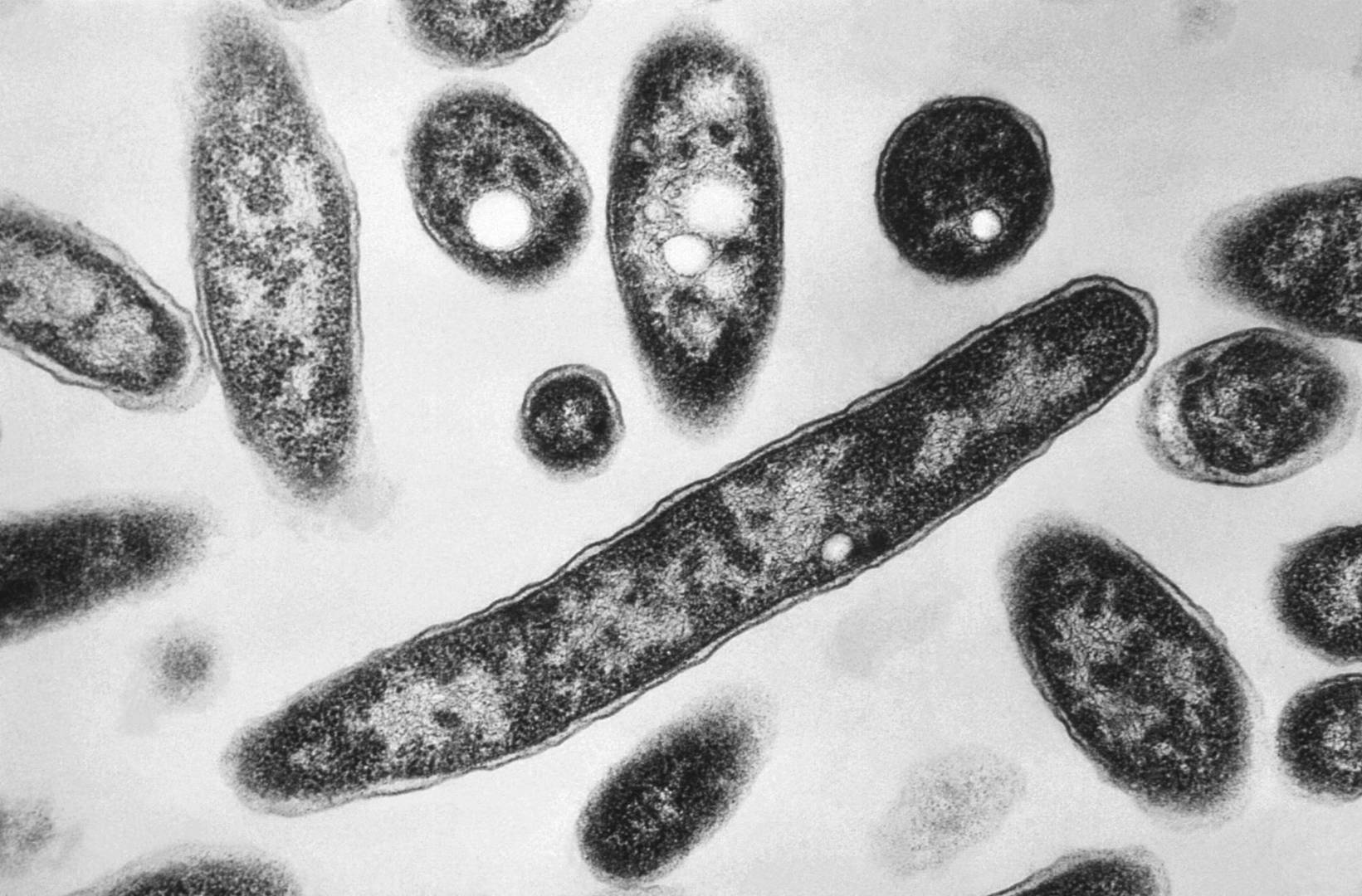 This 1978 electron microscope image made available by the Centers for Disease Control and Prevention shows Legionella pneumophila bacteria which are responsible for causing the pneumonic disease Legionnaires' disease. In a report released Wednesday, Aug. 14, 2019, the National Academies of Sciences, Engineering and Medicine said annual cases of Legionnaires’ jumped more than fivefold from 2000 to 2017, and that as many as 70,000 Americans get the disease every year. High-profile recent outbreaks occurred in Atlanta and Flint, Michigan. (Francis Chandler/CDC via AP)