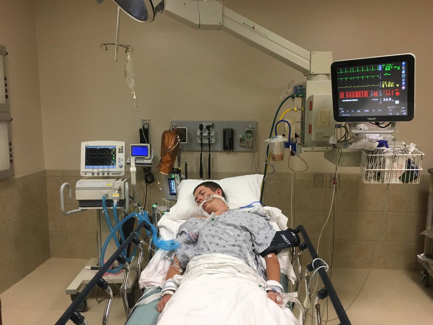 This May 2018, photo provided by Joseph Jenkins shows his son, Jay, in the emergency room of the Lexington Medical Center in Lexington, S.C. Jay Jenkins suffered acute respiratory failure and drifted into a coma, according to his medical records, after he says he vaped a product labeled as a smokable form of the cannabis extract CBD. Lab testing commissioned as part of an Associated Press investigation into CBD vapes showed the cartridge that Jenkins says he puffed contained a synthetic marijuana compound blamed for at least 11 deaths in Europe.  (Joseph Jenkins via AP)