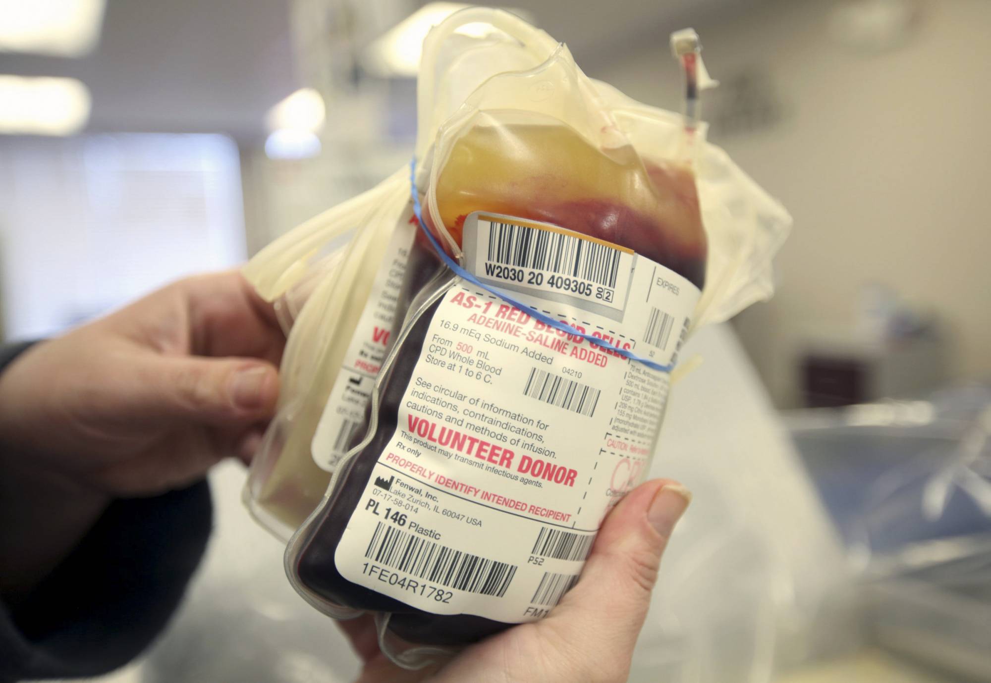 This Monday, March 9, 2020 file photo shows a packet of donated blood at The American Red Cross donation center in Scranton, Pa. On Friday, March 13, 2020, The Associated Press reported on stories circulating online incorrectly asserting that if you don’t have health insurance and can’t afford to take a $3,200 test for the COVID-19 coronavirus, donate blood because screeners must test donors for the virus. “We do a whole range of testing on blood donations as required by the FDA, but screening or testing for coronavirus is not happening,” said Kate Fry, chief executive officer of America’s Blood Centers, a North American network of nonprofit blood centers. (Jake Danna Stevens/The Times-Tribune via AP)