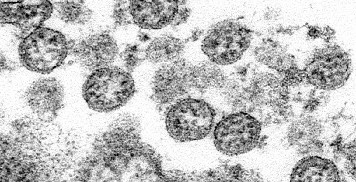 FILE - This 2020 electron microscope made available by the U.S. Centers for Disease Control and Prevention image shows the spherical coronavirus particles from the first U.S. case of COVID-19. On Friday, Sept. 18, 2020, The Associated Press reported on stories circulating online incorrectly asserting COVID-19 is a man-made virus intentionally manufactured in a lab and released to the public. Scientists say the molecular structure of SARS-CoV-2 rules out the possibility that the virus was created in a lab. (C.S. Goldsmith, A. Tamin/CDC via AP)